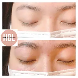 【大人気HBL】​〜​次世代ハリウッドブロウリフト(wax込)✨