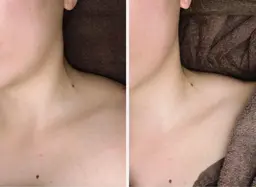 🉐エステ初めての方オススメ​〜​ベーシック​〜​40分