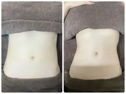 【つるんボディ＆即くびれ】インディバ＆カーボキシー炭酸ガスパック