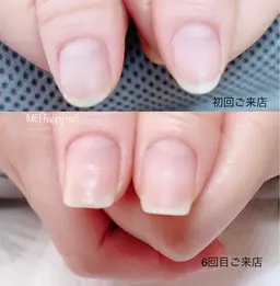 《美爪育成ネイルケア3ヶ月コース》合計8回(ご来店目安2週に1回)定期的なケアで自爪を健やかに保ち爪床の育成を促します