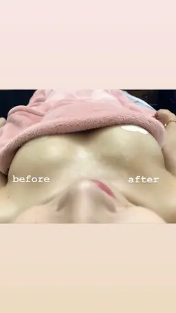 【バストケア】バストアップ施術(光施術付き)