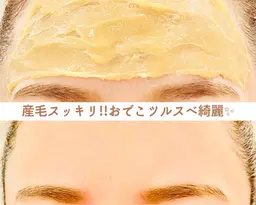 『毛の悩み・生え際・おでこのザラつきケア』+『アイブロウ天然WAX脱毛』アイブロウ＆額(おでこ)を同時に綺麗✨