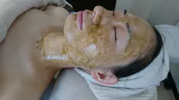 注目★【フェイシャル】毛穴つるつるたまご肌ハーブピーリングコース 45分