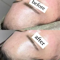 【学割U24】フェイスワックス/学生限定何度でも¥5,500