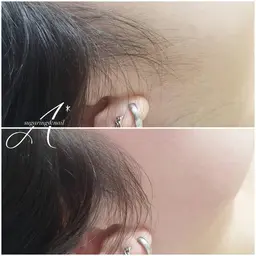 顔シュガーリング🍋（+他の箇所）