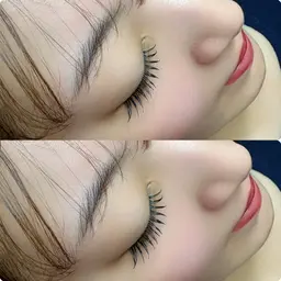 【フラットラッシュ100本】