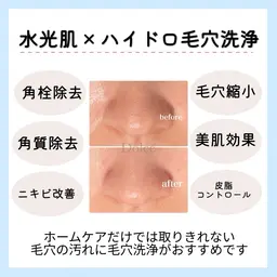 まずはお試し🦙⸝꙳【メンズもOK】水光肌ピーリング×ハイドロ毛穴洗浄