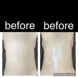 【ミニモ口コミ＋他口コミ1件】オイル筋膜剥がしエステ◎もも張り・ウエストダウン・デコルテバストアップ♪60分4400円