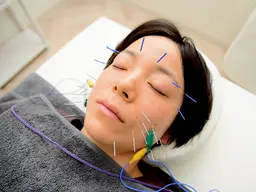 【初回美容鍼】美容鍼灸40分(箱灸付き)