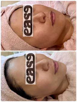 【瞬間小顔リフトアップコース💆‍♀️】表情筋トレーニングで引き上げ❣️目元口元フェイスラインすっきり