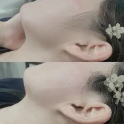 🥚ぷるぷる肌🥚になれるフェイシャルワックス✨(3パーツ価格✨)