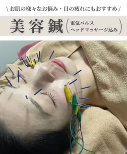 \ 人気No.2 / 美容鍼➕ヘッドマッサージ 【プレミアムコース】