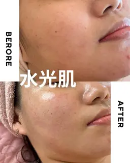 ⛄️冬の乾燥ケアに⛄️＼毛穴×乾燥×くすみ／水光ピーリング＋保湿＆美白パック◎ツヤ肌チャージで韓国美肌へ