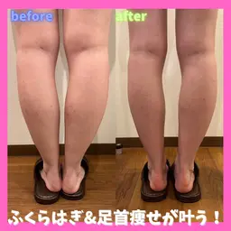 インディバ越えの機器で短期集中結果重視🔥韓国アイドル美脚に持っていく💎むくみセルライトを撃退.ᐟ