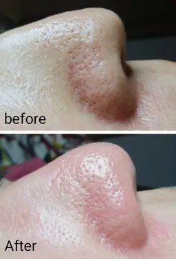 【🆕✨毛穴洗浄&引き締めフェイシャル】【メンズ大歓迎⭕️】