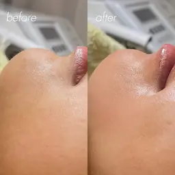 【WAXパーツ】眉まわり／鼻／口周り／うなじ etc