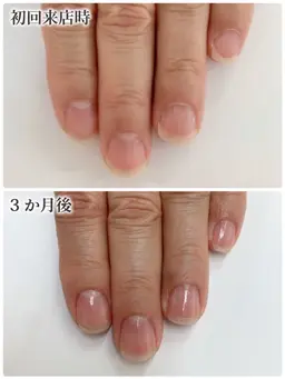 最強のネイルケアモデル 8～10回分