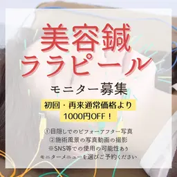 モニター📷美容鍼+小顔マッサージ+保湿仕上げ