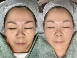 【ぷるぷる水光マイグロ二ドル】