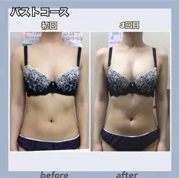 🌺口コミ投稿で２回券🦄マッサージ＆光照射＆EMSで劇的バストUP💖筋膜リリース肩甲骨はがしで背中美人✨