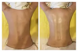 お試し背中ケア（セル脂肪ケア➕リンパドレナージュ）