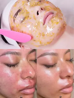 毛穴洗浄×顔ツボトリートメント×ハイドロジェリー/スピン肌ケア60分¥7980