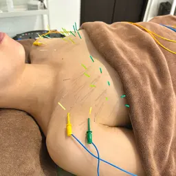 【バストアップ/ボリューム・ハリ感アップ】バストアップ美乳鍼