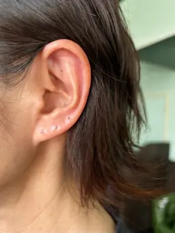 シンプル耳つぼシール20個まで