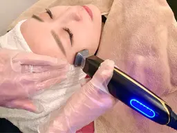 【お顔の脂肪、たるみ撃退】瞬間リフトアップ切らないVリフト