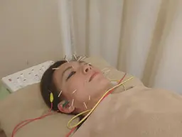 美顔造形鍼＋小顔矯正コース