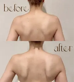 【疲労回復★】たるみ・肩こり・腰のだるさに！小顔×姿勢調整90分