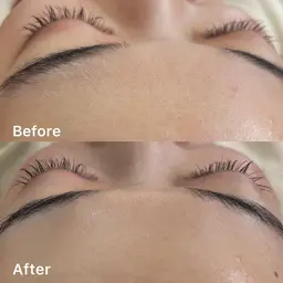 お顔剃り(フェイスシェービング)💆🏼‍♀️💎✨