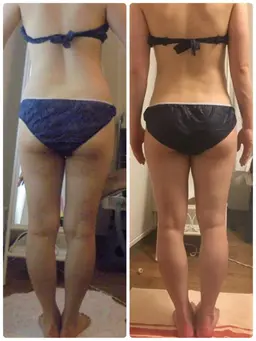 🍀全身!ダイエット2カ所光痩身コース (120分)⇨ 通常¥24,200- が初回限定 ¥12,000-で体験!