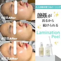 大人の肌を育てるピーリング【ラミネーションピール】（首・顔）たるみ・開き毛穴/韓国で話題ツヤ肌に