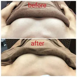 【バストケア】¥3,500バスト深部に専用機を照射すると、血流リンパの流れが良くなり、ハリと弾力のあるバストへ導きます。