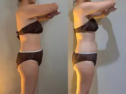 クリスタルドレナージュ痩身120分 クリスタルで固太り→ふわふわボディー/(全身)クリスタルドレナージュ®︎痩身リンパ