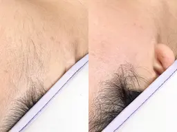 🆕【今話題の！！】フェイシャルワックスモニター様