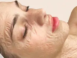 【ゾンビマスク】“塗るボトックス”と話題🧟‍♀エイジングケアに大人気のメニュー✨