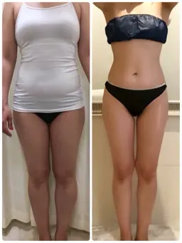 即効性重視！25,000→2,500円痩身エステ