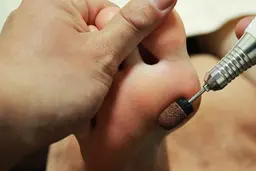 ドイツ式フットケア（両足）