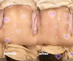 💖強力背中コルギ💖肩こり、肩甲骨のコリをほぐしてすっきりした背中、脇のリンパを刺激して脂肪にもアプローチ✨