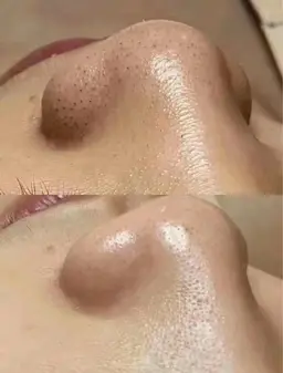 毛穴洗浄贅沢フルコ一ス70分★ 再来10500円→新規8300円