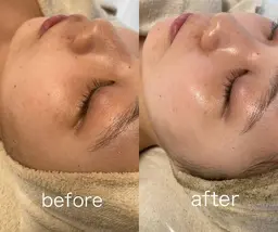 【悩まれたらまずこちら！】陶肌トリートメント💎次世代ハーブピーリング💎(陶肌パウダー2g)