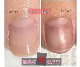 美自爪育成ケア💅コンプレックス解消🤗残席1名❗️3ヶ月間に8回のご来店です。※詳細をご覧ください♡