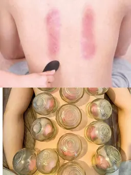 【不眠/倦怠感が強い方】オイル+カッサ+カッピング90分♪(全員別途シーツ代300円)