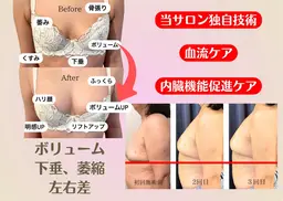 【結果重視】深部加温×微弱電流で根本ケア!本気のバストUP施術