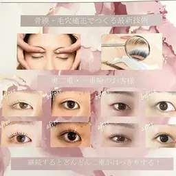 眼精疲労むくみに⭐️目元の美容整体アイストレッチ💆🏻‍♀️