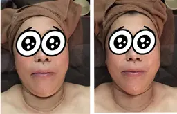 速攻小顔フェイシャル