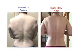 【オールハンド痩身🔥本気痩せ・デトックス‼️】腸揉み＋全身オールハンドマッサージ 120分