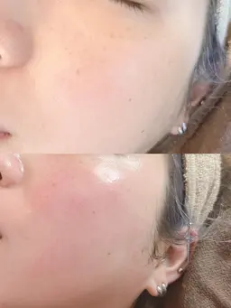 ✨✨期間限定価格✨✨　　　　　　　　　　　　　　　フェイシャルWAX＋クレンジング&保湿パック付き